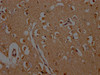 IHC image of CSB-PA892176HA01HU diluted at 1:200 and staining in paraffin-embedded human brain tissue performed on a Leica BondTM system. After dewaxing and hydration, antigen retrieval was mediated by high pressure in a citrate buffer (pH 6.0) . Section was blocked with 10% normal goat serum 30min at RT. Then primary antibody (1% BSA) was incubated at 4°C overnight. The primary is detected by a Goat anti-rabbit polymer IgG labeled by HRP and visualized using 0.05% DAB.