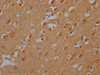 IHC image of CSB-PA892176HA11HU diluted at 1:200 and staining in paraffin-embedded human brain tissue performed on a Leica BondTM system. After dewaxing and hydration, antigen retrieval was mediated by high pressure in a citrate buffer (pH 6.0) . Section was blocked with 10% normal goat serum 30min at RT. Then primary antibody (1% BSA) was incubated at 4°C overnight. The primary is detected by a Goat anti-rabbit polymer IgG labeled by HRP and visualized using 0.05% DAB.