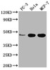 Western Blot<br />
 Positive WB detected in: PC-3 whole cell lysate, Hela whole cell lysate, MCF-7 whole cell lysate<br />
 All lanes: CCDC74B antibody at 1:2000<br />
 Secondary<br />
 Goat polyclonal to rabbit IgG at 1/50000 dilution<br />
 Predicted band size: 42, 36 kDa<br />
 Observed band size: 42 kDa<br />