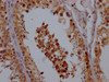 IHC image of CSB-PA861130LA01HU diluted at 1:200 and staining in paraffin-embedded human testis tissue performed on a Leica BondTM system. After dewaxing and hydration, antigen retrieval was mediated by high pressure in a citrate buffer (pH 6.0) . Section was blocked with 10% normal goat serum 30min at RT. Then primary antibody (1% BSA) was incubated at 4°C overnight. The primary is detected by a Goat anti-rabbit polymer IgG labeled by HRP and visualized using 0.05% DAB.