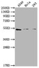 Western Blot<br />
 Positive WB detected in: A549 whole cell lysate, Hela whole cell lysate, 293 whole cell lysate<br />
 All lanes: CNR1 antibody at 1:2000<br />
 Secondary<br />
 Goat polyclonal to rabbit IgG at 1/50000 dilution<br />
 Predicted band size: 53, 46, 50 kDa<br />
 Observed band size: 53 kDa<br />