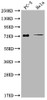 Western Blot<br />
 Positive WB detected in: PC-3 whole cell lysate, Hela whole cell lysate<br />
 All lanes: GLB1L3 antibody at 1:2000<br />
 Secondary<br />
 Goat polyclonal to rabbit IgG at 1/50000 dilution<br />
 Predicted band size: 75, 36 kDa<br />
 Observed band size: 75 kDa<br />