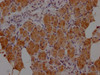 IHC image of CSB-PA010879NA01HU diluted at 1:100 and staining in paraffin-embedded human salivary gland tissue performed on a Leica BondTM system. After dewaxing and hydration, antigen retrieval was mediated by high pressure in a citrate buffer (pH 6.0) . Section was blocked with 10% normal goat serum 30min at RT. Then primary antibody (1% BSA) was incubated at 4°C overnight. The primary is detected by a Goat anti-rabbit IgG labeled by HRP and visualized using 0.05% DAB.