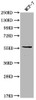 Western Blot<br />
 Positive WB detected in: MCF-7 whole cell lysate<br />
 All lanes: ITPRIPL2 antibody at 1:2000<br />
 Secondary<br />
 Goat polyclonal to rabbit IgG at 1/50000 dilution<br />
 Predicted band size: 59 kDa<br />
 Observed band size: 59 kDa<br />