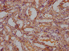 IHC image of CSB-PA714125OA01RA diluted at 1:300 and staining in paraffin-embedded Rat kidney tissue performed on a Leica BondTM system. After dewaxing and hydration, antigen retrieval was mediated by high pressure in a citrate buffer (pH 6.0) . Section was blocked with 10% normal goat serum 30min at RT. Then primary antibody (1% BSA) was incubated at 4°C overnight. The primary is detected by a Goat anti-rabbit polymer IgG labeled by HRP and visualized using 0.05% DAB.