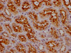 IHC image of CSB-PA014653LA11HU diluted at 1:200 and staining in paraffin-embedded human kidney tissue performed on a Leica BondTM system. After dewaxing and hydration, antigen retrieval was mediated by high pressure in a citrate buffer (pH 6.0) . Section was blocked with 10% normal goat serum 30min at RT. Then primary antibody (1% BSA) was incubated at 4°C overnight. The primary is detected by a Goat anti-rabbit polymer IgG labeled by HRP and visualized using 0.05% DAB.