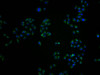 Immunofluorescence staining of Hela cells with CSB-PA014653LA11HU at 1:100, counter-stained with DAPI. The cells were fixed in 4% formaldehyde and blocked in 10% normal Goat Serum. The cells were then incubated with the antibody overnight at 4°C. The secondary antibody was Alexa Fluor 488-congugated AffiniPure Goat Anti-Rabbit IgG (H+L) .