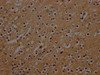 IHC image of CSB-PA015686LA01HU diluted at 1:300 and staining in paraffin-embedded human brain tissue performed on a Leica BondTM system. After dewaxing and hydration, antigen retrieval was mediated by high pressure in a citrate buffer (pH 6.0) . Section was blocked with 10% normal goat serum 30min at RT. Then primary antibody (1% BSA) was incubated at 4°C overnight. The primary is detected by a Goat anti-rabbit polymer IgG labeled by HRP and visualized using 0.05% DAB.