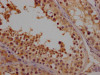 IHC image of CSB-PA615689LA01HU diluted at 1:100 and staining in paraffin-embedded human testis tissue performed on a Leica BondTM system. After dewaxing and hydration, antigen retrieval was mediated by high pressure in a citrate buffer (pH 6.0) . Section was blocked with 10% normal goat serum 30min at RT. Then primary antibody (1% BSA) was incubated at 4°C overnight. The primary is detected by a Goat anti-rabbit polymer IgG labeled by HRP and visualized using 0.05% DAB.