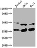 Western Blot<br />
 Positive WB detected in: Jurkat whole cell lysate, Hela whole cell lysate, Raji whole cell lysate<br />
 All lanes: NFKBIA antibody at 1:2000<br />
 Secondary<br />
 Goat polyclonal to rabbit IgG at 1/50000 dilution<br />
 Predicted band size: 36 kDa<br />
 Observed band size: 36 kDa<br />
