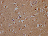 IHC image of CSB-PA884445NA01HU diluted at 1:200 and staining in paraffin-embedded human brain tissue performed on a Leica BondTM system. After dewaxing and hydration, antigen retrieval was mediated by high pressure in a citrate buffer (pH 6.0) . Section was blocked with 10% normal goat serum 30min at RT. Then primary antibody (1% BSA) was incubated at 4°C overnight. The primary is detected by a Goat anti-rabbit polymer IgG labeled by HRP and visualized using 0.05% DAB.