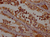 IHC image of CSB-PA847729OA01HU diluted at 1:200 and staining in paraffin-embedded human testis tissue performed on a Leica BondTM system. After dewaxing and hydration, antigen retrieval was mediated by high pressure in a citrate buffer (pH 6.0) . Section was blocked with 10% normal goat serum 30min at RT. Then primary antibody (1% BSA) was incubated at 4°C overnight. The primary is detected by a Goat anti-rabbit polymer IgG labeled by HRP and visualized using 0.05% DAB.