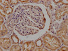 IHC image of CSB-PA836757OA01HU diluted at 1:200 and staining in paraffin-embedded human kidney tissue performed on a Leica BondTM system. After dewaxing and hydration, antigen retrieval was mediated by high pressure in a citrate buffer (pH 6.0) . Section was blocked with 10% normal goat serum 30min at RT. Then primary antibody (1% BSA) was incubated at 4°C overnight. The primary is detected by a Goat anti-rabbit polymer IgG labeled by HRP and visualized using 0.05% DAB. IHC image of CSB-PA836757OA01HU diluted at 1:200 and staining in paraffin-embedded human kidney tissue performed on a Leica BondTM system. After dewaxing and hydration, antigen retrieval was mediated by high pressure in a citrate buffer (pH 6.0) . Section was blocked with 10% normal goat serum 30min at RT. Then primary antibody (1% BSA) was incubated at 4°C overnight. The primary is detected by a Goat anti-rabbit polymer IgG labeled by HRP and visualized using 0.05% DAB.