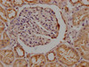 IHC image of CSB-PA836757OA01HU diluted at 1:200 and staining in paraffin-embedded human kidney tissue performed on a Leica BondTM system. After dewaxing and hydration, antigen retrieval was mediated by high pressure in a citrate buffer (pH 6.0) . Section was blocked with 10% normal goat serum 30min at RT. Then primary antibody (1% BSA) was incubated at 4°C overnight. The primary is detected by a Goat anti-rabbit polymer IgG labeled by HRP and visualized using 0.05% DAB.