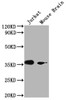 Western Blot<br />
 Positive WB detected in: Jurkat whole cell lysate, Mouse Brain tissue<br />
 All lanes: OR51F2 antibody at 1:2000<br />
 Secondary<br />
 Goat polyclonal to rabbit IgG at 1/50000 dilution<br />
 Predicted band size: 39 kDa<br />
 Observed band size: 39 kDa<br />