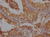 IHC image of CSB-PA854129OA01HU diluted at 1:200 and staining in paraffin-embedded human testis tissue performed on a Leica BondTM system. After dewaxing and hydration, antigen retrieval was mediated by high pressure in a citrate buffer (pH 6.0) . Section was blocked with 10% normal goat serum 30min at RT. Then primary antibody (1% BSA) was incubated at 4°C overnight. The primary is detected by a Goat anti-rabbit polymer IgG labeled by HRP and visualized using 0.05% DAB.