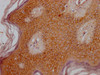 IHC image of CSB-PA847734OA01HU diluted at 1:300 and staining in paraffin-embedded human skin tissue performed on a Leica BondTM system. After dewaxing and hydration, antigen retrieval was mediated by high pressure in a citrate buffer (pH 6.0) . Section was blocked with 10% normal goat serum 30min at RT. Then primary antibody (1% BSA) was incubated at 4°C overnight. The primary is detected by a Goat anti-rabbit polymer IgG labeled by HRP and visualized using 0.05% DAB.