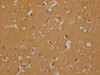 IHC image of CSB-PA847734OA01HU diluted at 1:300 and staining in paraffin-embedded human brain tissue performed on a Leica BondTM system. After dewaxing and hydration, antigen retrieval was mediated by high pressure in a citrate buffer (pH 6.0) . Section was blocked with 10% normal goat serum 30min at RT. Then primary antibody (1% BSA) was incubated at 4°C overnight. The primary is detected by a Goat anti-rabbit polymer IgG labeled by HRP and visualized using 0.05% DAB.