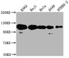 Western Blot<br />
 Positive WB detected in: K562 whole cell lysate, Raji whole cell lysate, Hela whole cell lysate, A549 whole cell lysate, NTERA-2 whole cell lysate<br />
 All lanes: PARP1 antibody at 1:2000<br />
 Secondary<br />
 Goat polyclonal to rabbit IgG at 1/50000 dilution<br />
 Predicted band size: 114 kDa<br />
 Observed band size: 114 kDa<br />