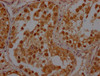IHC image of CSB-PA02519A0Rb diluted at 1:400 and staining in paraffin-embedded human testis tissue performed on a Leica BondTM system. After dewaxing and hydration, antigen retrieval was mediated by high pressure in a citrate buffer (pH 6.0) . Section was blocked with 10% normal goat serum 30min at RT. Then primary antibody (1% BSA) was incubated at 4°C overnight. The primary is detected by a Goat anti-rabbit polymer IgG labeled by HRP and visualized using 0.05% DAB.