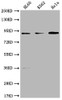 Western Blot<br />
 Positive WB detected in: HL60 whole cell lysate, K562 whole cell lysate, Hela whole cell lysate<br />
 All lanes: RPTN antibody at 1:1000<br />
 Secondary<br />
 Goat polyclonal to rabbit IgG at 1/50000 dilution<br />
 Predicted band size: 91 kDa<br />
 Observed band size: 91 kDa<br />