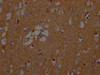 IHC image of CSB-PA021434LA01HU diluted at 1:200 and staining in paraffin-embedded human brain tissue performed on a Leica BondTM system. After dewaxing and hydration, antigen retrieval was mediated by high pressure in a citrate buffer (pH 6.0) . Section was blocked with 10% normal goat serum 30min at RT. Then primary antibody (1% BSA) was incubated at 4°C overnight. The primary is detected by a Goat anti-rabbit polymer IgG labeled by HRP and visualized using 0.05% DAB.