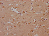 IHC image of CSB-PA022650LA01HU diluted at 1:200 and staining in paraffin-embedded human brain tissue performed on a Leica BondTM system. After dewaxing and hydration, antigen retrieval was mediated by high pressure in a citrate buffer (pH 6.0) . Section was blocked with 10% normal goat serum 30min at RT. Then primary antibody (1% BSA) was incubated at 4°C overnight. The primary is detected by a Goat anti-rabbit polymer IgG labeled by HRP and visualized using 0.05% DAB.
