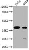 Western Blot<br />
 Positive WB detected in: Hela whole cell lysate, A549 whole cell lysate<br />
 All lanes: TAS2R7 antibody at 1:2000<br />
 Secondary<br />
 Goat polyclonal to rabbit IgG at 1/50000 dilution<br />
 Predicted band size: 37 kDa<br />
 Observed band size: 37 kDa<br />