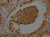 IHC image of CSB-PA025898LA01HU diluted at 1:200 and staining in paraffin-embedded human testis tissue performed on a Leica BondTM system. After dewaxing and hydration, antigen retrieval was mediated by high pressure in a citrate buffer (pH 6.0) . Section was blocked with 10% normal goat serum 30min at RT. Then primary antibody (1% BSA) was incubated at 4°C overnight. The primary is detected by a Goat anti-rabbit polymer IgG labeled by HRP and visualized using 0.05% DAB.