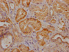 IHC image of CSB-PA025898LA11HU diluted at 1:300 and staining in paraffin-embedded human kidney tissue performed on a Leica BondTM system. After dewaxing and hydration, antigen retrieval was mediated by high pressure in a citrate buffer (pH 6.0) . Section was blocked with 10% normal goat serum 30min at RT. Then primary antibody (1% BSA) was incubated at 4°C overnight. The primary is detected by a Goat anti-rabbit polymer IgG labeled by HRP and visualized using 0.05% DAB.