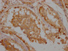 IHC image of CSB-PA025898LA11HU diluted at 1:300 and staining in paraffin-embedded human testis tissue performed on a Leica BondTM system. After dewaxing and hydration, antigen retrieval was mediated by high pressure in a citrate buffer (pH 6.0) . Section was blocked with 10% normal goat serum 30min at RT. Then primary antibody (1% BSA) was incubated at 4°C overnight. The primary is detected by a Goat anti-rabbit polymer IgG labeled by HRP and visualized using 0.05% DAB.