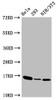 Western Blot<br />
 Positive WB detected in：Hela whole cell lysate，293 whole cell lysate，NIH/3T3 whole cell lysate<br />
 All lanes：Phospho-Histone H3 (T3) antibody at 1.41µg/ml<br />
 Secondary<br />
 Goat polyclonal to rabbit IgG at 1/50000 dilution<br />
 Predicted band size: 16 KDa<br />
 Observed band size: 16 KDa<br />