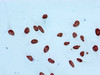 Immunocytochemistry analysis of CSB-RA010418A04me2HU diluted at 1:100 and staining in Hela cells performed on a Leica BondTM system. After dewaxing and hydration, antigen retrieval was mediated by high pressure in a citrate buffer (pH 6.0). Section was blocked with 10% normal goat serum 30min at RT. Then primary antibody (1% BSA) was incubated at 4°C overnight. The primary is detected by a biotinylated secondary antibody and visualized using an HRP conjugated SP system.