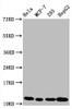 Western Blot<br />
 Positive WB detected in：Hela whole cell lysate，MCF-7 whole cell lysate，293 whole cell lysate，HepG2 whole cell lysate<br />
 All lanes：Acetyl-Histone H4 (K5) antibody at 1.05µg/ml<br />
 Secondary<br />
 Goat polyclonal to rabbit IgG at 1/50000 dilution<br />
 Predicted band size: 11 KDa<br />
 Observed band size: 11 KDa<br />