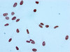 Immunocytochemistry analysis of CSB-RA010385A09acHU diluted at 1:100 and staining in Hela cells performed on a Leica BondTM system. After dewaxing and hydration, antigen retrieval was mediated by high pressure in a citrate buffer (pH 6.0). Section was blocked with 10% normal goat serum 30min at RT. Then primary antibody (1% BSA) was incubated at 4°C overnight. The primary is detected by a biotinylated secondary antibody and visualized using an HRP conjugated SP system.