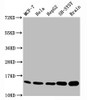 Western Blot<br />
 Positive WB detected in：MCF-7 whole cell lysate，Hela whole cell lysate，HepG2 whole cell lysate，SH-SY5Y whole cell lysate,Rat brain tissue<br />
 All lanes：Mono-methyl-Histone H3.1（K18）antibody at 0.7µg/ml<br />
 Secondary<br />
 Goat polyclonal to rabbit IgG at 1/50000 dilution<br />
 Predicted band size: 15 KDa<br />
 Observed band size: 15 KDa<br />