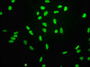 Immunofluorescence staining of Hela cells（treated by 15mM sodium butyrate for 30min） with CSB-RA010418A04acHU at 1:68,counter-stained with DAPI. The cells were fixed in 4% formaldehyde, permeabilized using 0.2% Triton X-100 and blocked in 10% normal Goat Serum. The cells were then incubated with the antibody overnight at 4°C.The secondary antibody was Alexa Fluor 488-congugated AffiniPure Goat Anti-Rabbit IgG (H+L).