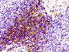 IHC image of CSB-RA004935A0HU diluted at 1:100 and staining in paraffin-embedded human spleen tissue performed on a Leica BondTM system. After dewaxing and hydration, antigen retrieval was mediated by high pressure in a citrate buffer (pH 6.0). Section was blocked with 10% normal goat serum 30min at RT. Then primary antibody (1% BSA) was incubated at 4°C overnight. The primary is detected by a biotinylated secondary antibody and visualized using an HRP conjugated SP system.