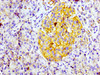 IHC image of CSB-RA004973A0HU diluted at 1:100 and staining in paraffin-embedded human pancreatic tissue performed on a Leica BondTM system. After dewaxing and hydration, antigen retrieval was mediated by high pressure in a citrate buffer (pH 6.0). Section was blocked with 10% normal goat serum 30min at RT. Then primary antibody (1% BSA) was incubated at 4°C overnight. The primary is detected by a biotinylated secondary antibody and visualized using an HRP conjugated SP system.