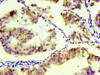 IHC image of CSB-RA004956A0HU diluted at 1:100 and staining in paraffin-embedded human endometrial tissue performed on a Leica BondTM system. After dewaxing and hydration, antigen retrieval was mediated by high pressure in a citrate buffer (pH 6.0). Section was blocked with 10% normal goat serum 30min at RT. Then primary antibody (1% BSA) was incubated at 4°C overnight. The primary is detected by a biotinylated secondary antibody and visualized using an HRP conjugated SP system.