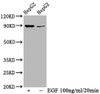 Western Blot<br />
 Positive WB detected in：HepG2 whole cell lysate(treated with EGF or not)<br />
 All lanes：Phospho-RPS6KA1 antibody at 0.69µg/ml<br />
 Secondary<br />
 Goat polyclonal to rabbit IgG at 1/50000 dilution<br />
 Predicted band size: 90 KDa<br />
 Observed band size: 90 KDa<br />