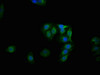 Immunofluorescence staining of HepG2 cells with CSB-RA010078A641phHU at 1:100,counter-stained with DAPI. The cells were fixed in 4% formaldehyde, permeabilized using 0.2% Triton X-100 and blocked in 10% normal Goat Serum. The cells were then incubated with the antibody overnight at 4°C. The secondary antibody was Alexa Fluor 488-congugated AffiniPure Goat Anti-Rabbit IgG (H+L).