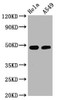 Western Blot<br />
 Positive WB detected in：Hela whole cell lysate,A549 whole cell lysate<br />
 All lanes：Phospho-GATA3 antibody at 2.5µg/ml<br />
 Secondary<br />
 Goat polyclonal to rabbit IgG at 1/50000 dilution<br />
 Predicted band size: 48 KDa<br />
 Observed band size: 48 KDa<br />