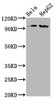 Western Blot<br />
 Positive WB detected in：Hela whole cell lysate,HepG2 whole cell lysate<br />
 All lanes：Phospho-NBN antibody at 1.98µg/ml<br />
 Secondary<br />
 Goat polyclonal to rabbit IgG at 1/50000 dilution<br />
 Predicted band size: 95 KDa<br />
 Observed band size: 95 KDa<br />