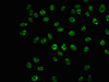 Immunofluorescence staining of Hela cells with CSB-RA020470A421phHU at 1:100,counter-stained with DAPI. The cells were fixed in 4% formaldehyde, permeabilized using 0.2% Triton X-100 and blocked in 10% normal Goat Serum. The cells were then incubated with the antibody overnight at 4°C. The secondary antibody was Alexa Fluor 488-congugated AffiniPure Goat Anti-Rabbit IgG (H+L).