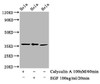 Western Blot<br />
 Positive WB detected in：Hela whole cell lysate(treated with Calyculin A or EGF) <br />
 All lanes：Phospho-EIF2S1 antibody at 1.48µg/ml<br />
 Secondary<br />
 Goat polyclonal to rabbit IgG at 1/50000 dilution<br />
 Predicted band size: 36 KDa<br />
 Observed band size: 36 KDa<br />