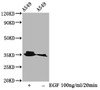 Western Blot<br />
 Positive WB detected in：A549 whole cell lysate(treated with EGF or not)<br />
 All lanes：Phospho-PPP2CA antibody at 0.95µg/ml<br />
 Secondary<br />
 Goat polyclonal to rabbit IgG at 1/50000 dilution<br />
 Predicted band size: 35 KDa<br />
 Observed band size: 35 KDa<br />