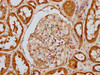 IHC image of CSB-RA007511A446phHU diluted at 1:100 and staining in paraffin-embedded human kidney tissue performed on a Leica BondTM system. After dewaxing and hydration, antigen retrieval was mediated by high pressure in a citrate buffer (pH 6.0). Section was blocked with 10% normal goat serum 30min at RT. Then primary antibody (1% BSA) was incubated at 4°C overnight. The primary is detected by a biotinylated secondary antibody and visualized using an HRP conjugated SP system.