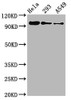 Western Blot<br />
 Positive WB detected in：Hela whole cell lysate，293 whole cell lysate，A549 whole cell lysate<br />
 All lanes：Phospho-FOXO3 antibody at 0.96µg/ml<br />
 Secondary<br />
 Goat polyclonal to rabbit IgG at 1/50000 dilution<br />
 Predicted band size: 97 KDa<br />
 Observed band size: 97 KDa<br />