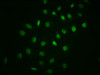Immunofluorescence staining of A549 cells with CSB-RA015761A32phHU at 1:100,counter-stained with DAPI. The cells were fixed in 4% formaldehyde, permeabilized using 0.2% Triton X-100 and blocked in 10% normal Goat Serum. The cells were then incubated with the antibody overnight at 4°C. The secondary antibody was Alexa Fluor 488-congugated AffiniPure Goat Anti-Rabbit IgG (H+L).